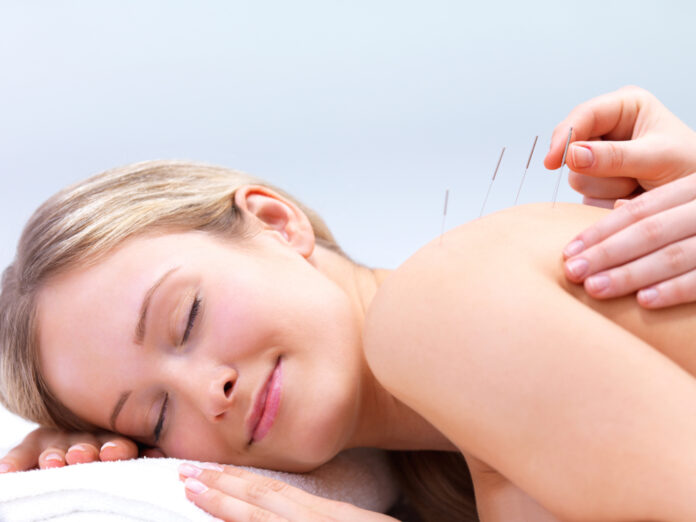 Dry needling Melbourne